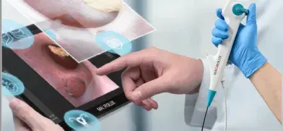 Broncoscopio Macrolux