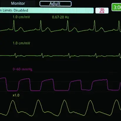 Monitor-Desfibrilador M2