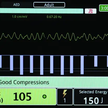 Monitor-Desfibrilador M2