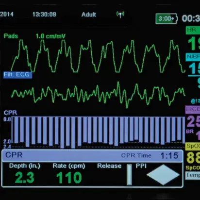 Monitos-Desfibrilador X-Series