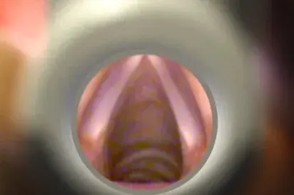 2. Lleve el Vie Scope por debajo de la epiglotis directamente hacia las cuerdas vocales.