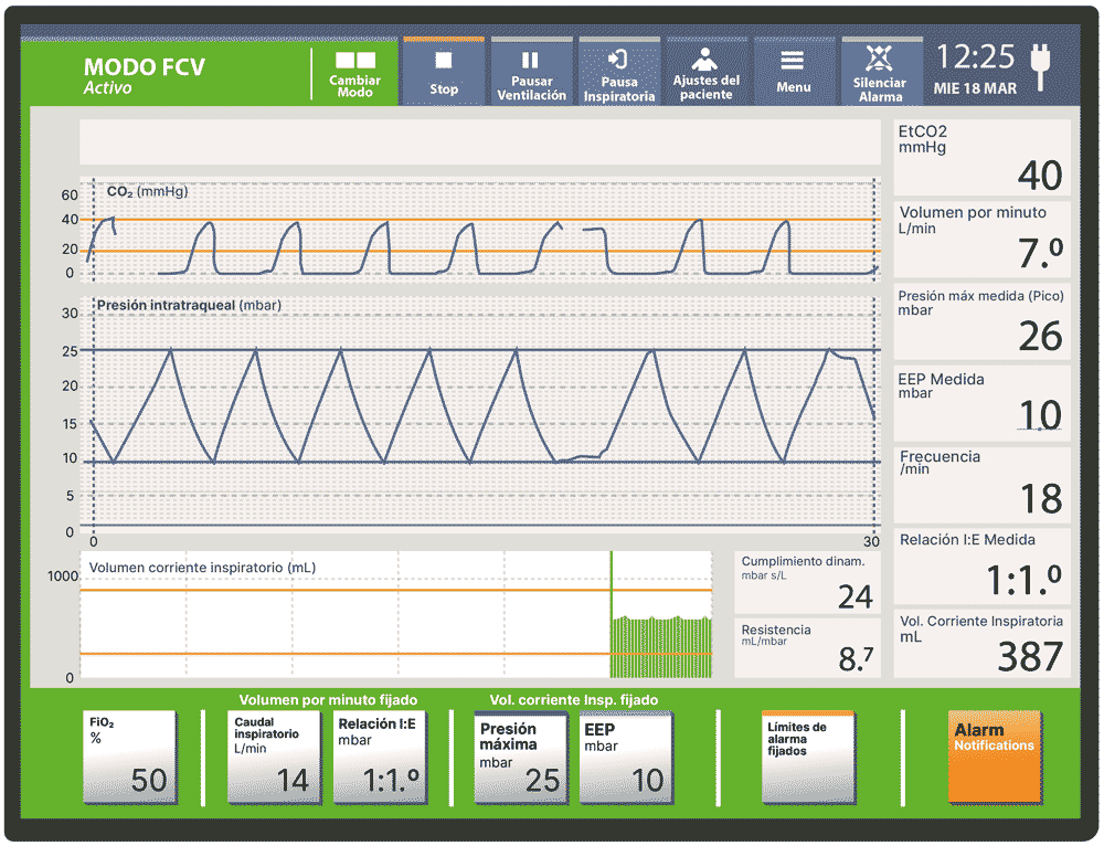 Pantalla que muestra las gráficas de ventilación del EVONE