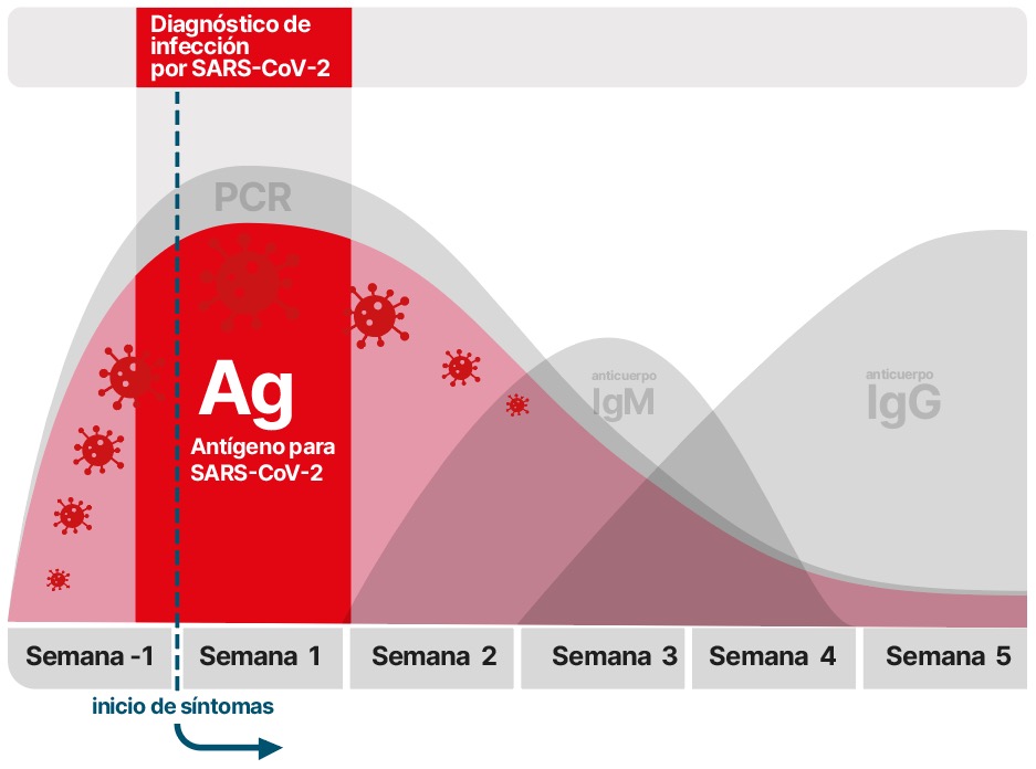 Gráfica diagnostico covid