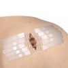DynaStretch cierre heridas sin tensión