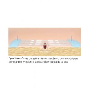 Tiras DynaStretch para aplicación prequirúrgica