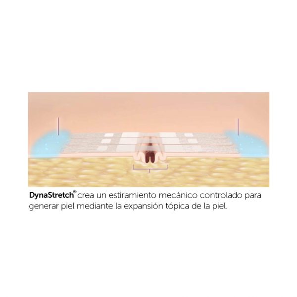 Tiras DynaStretch para aplicación prequirúrgica