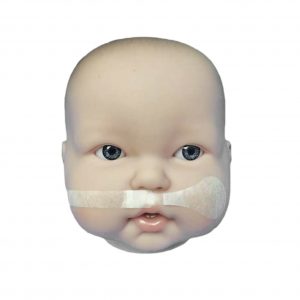 Sistema para tratamiento labio fisurado (labio leporino)